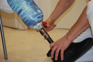 Unterschenkelprothese